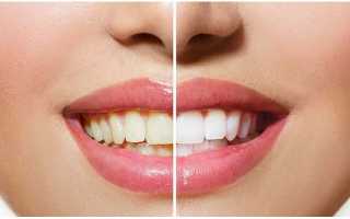 Зубные пасты Colgate Optic White