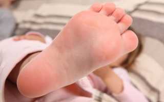 Шипы на ступнях: причины появления и методы лечения